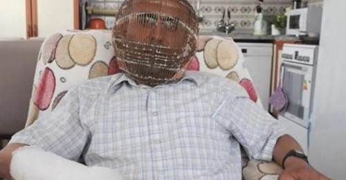 Τούρκος κλείδωσε το κεφάλι του σε κλουβί για να κόψει το κάπνισμα